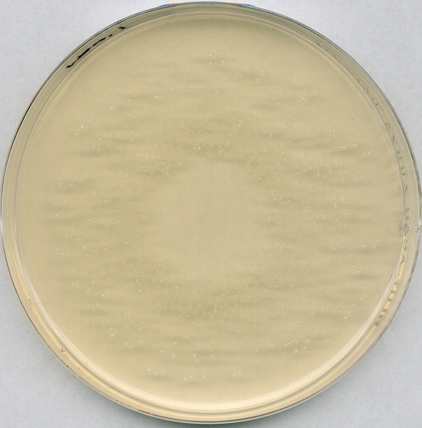 Rogosa Agar
